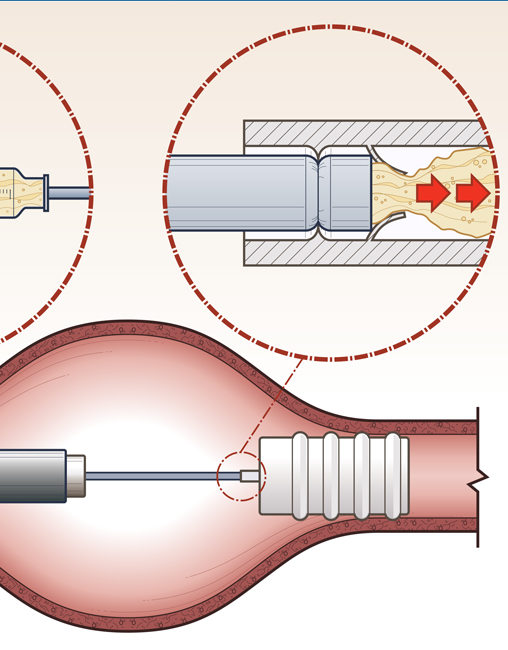 Surgical Procedure Step-by-Step